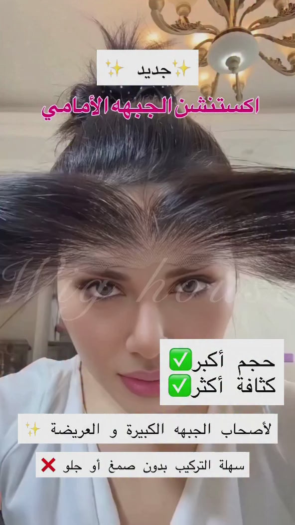 اكستنشن الجبهه الامامي  بحجم و عرض أكبر

Forehead extension